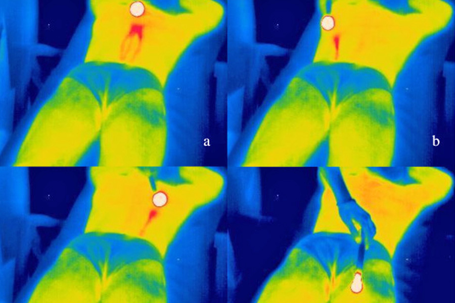 Les méridiens existent-ils ? - Fig 1. thermogrammes sur un corps humain